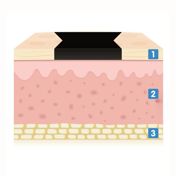 Skin Layers
