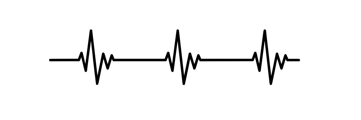 Heartbeat Pulse Graph 1 - Temporalis